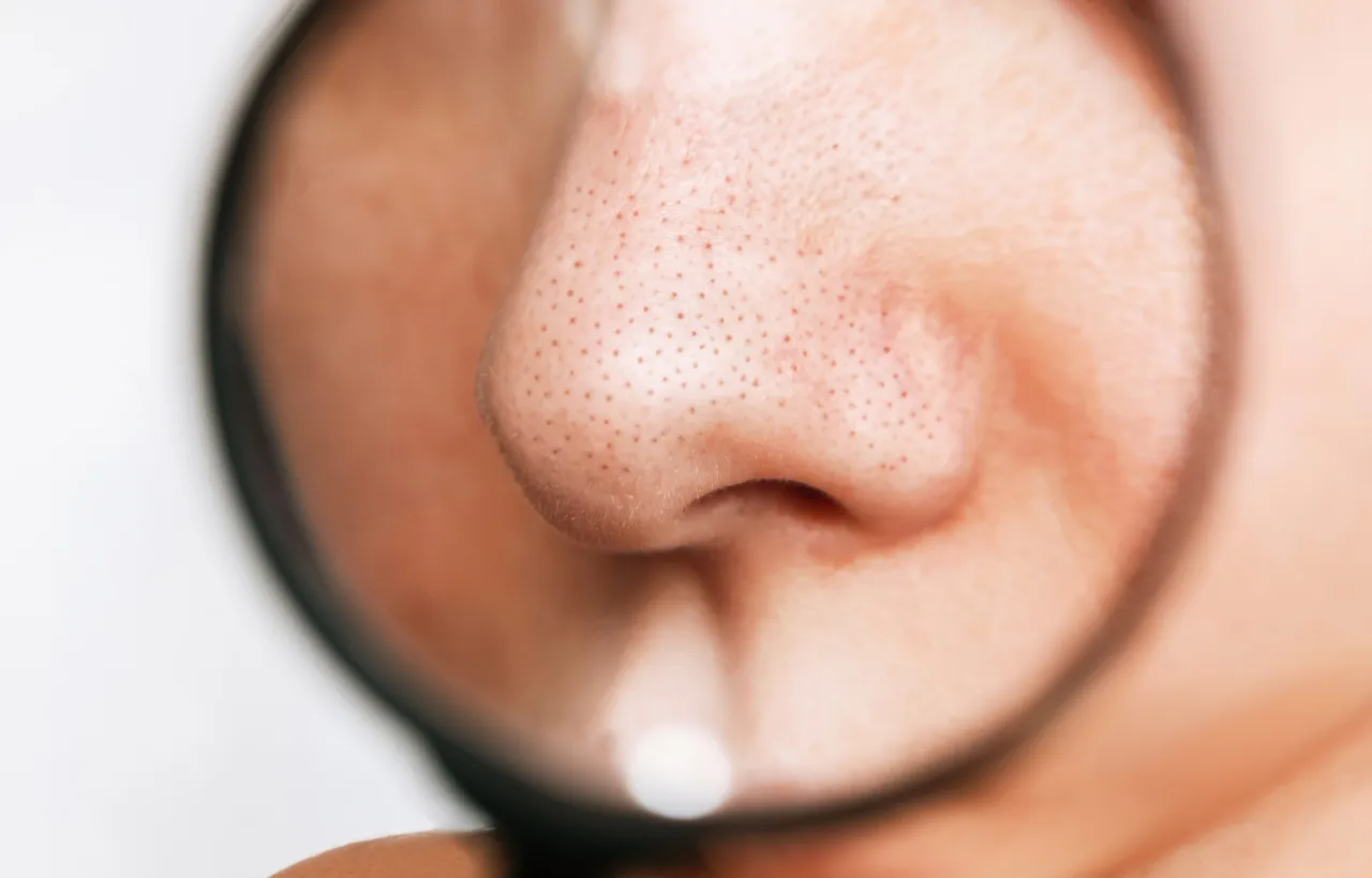 nose pores unclog