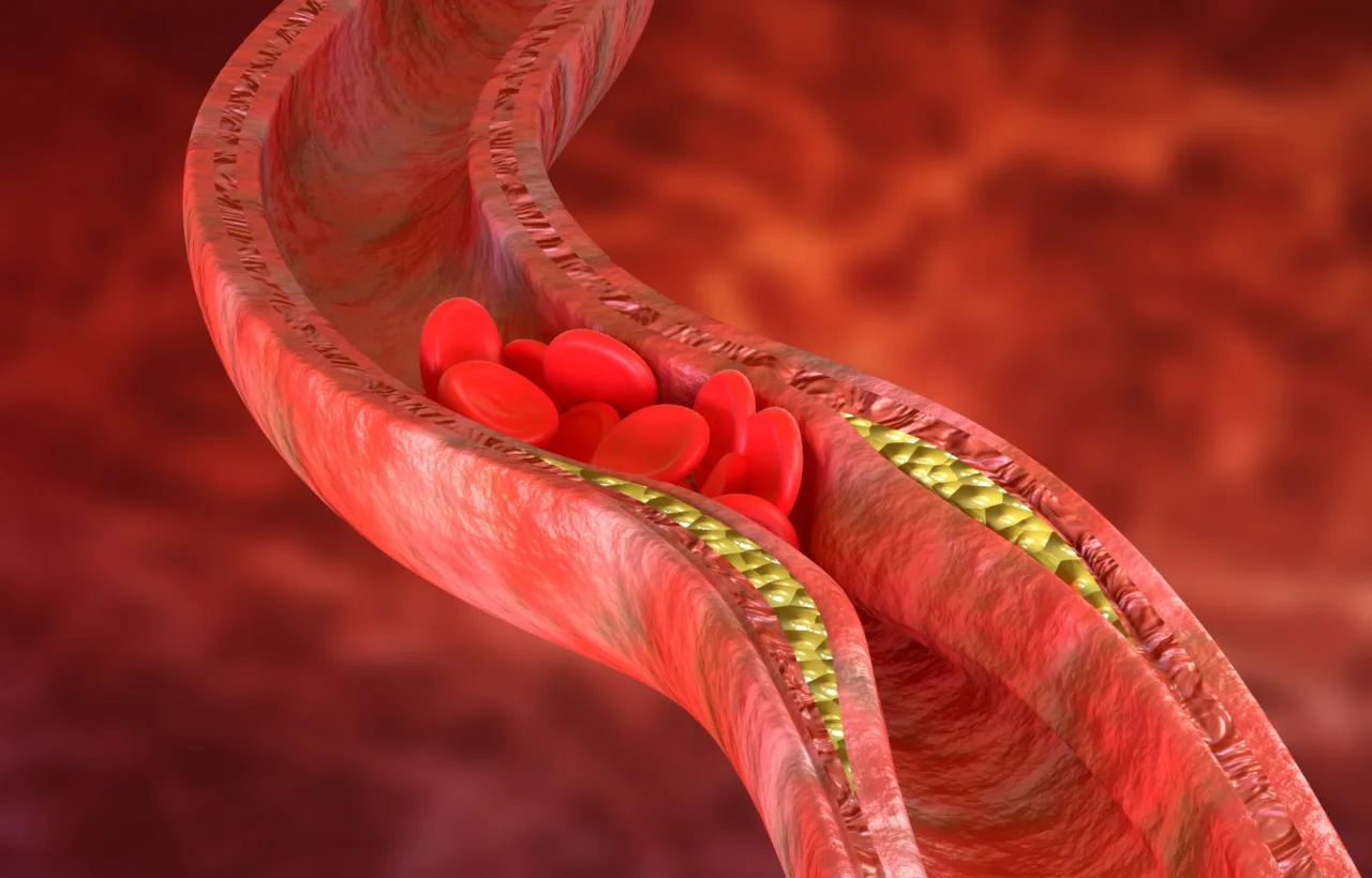 unclog arteries natural
