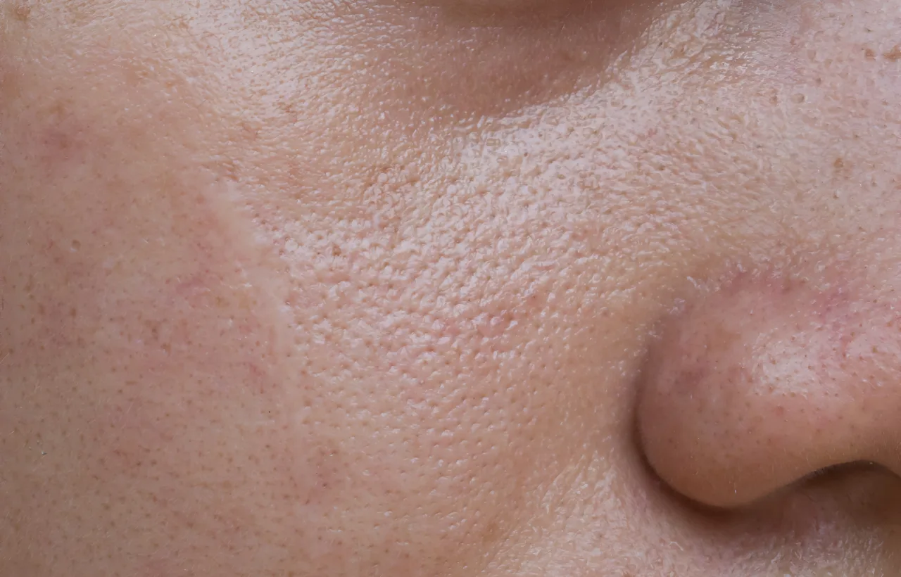 unclog pores